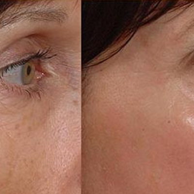 Arkansas Laser & Skin Care