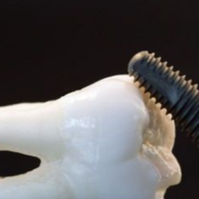 First Impressions Dental Lab