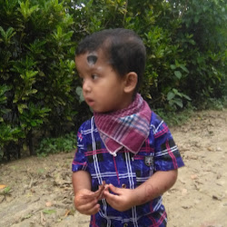 SST APON