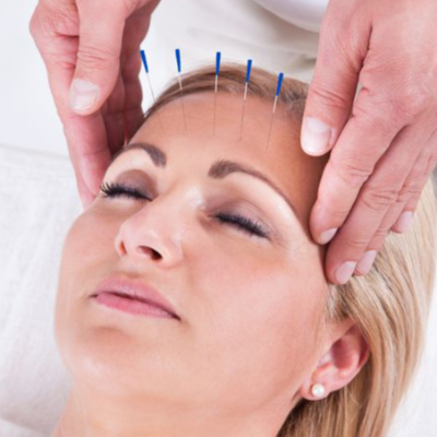 Barrhaven Chinese Acupuncture Clinic